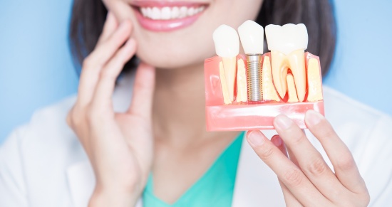 implantes dentales valencia
